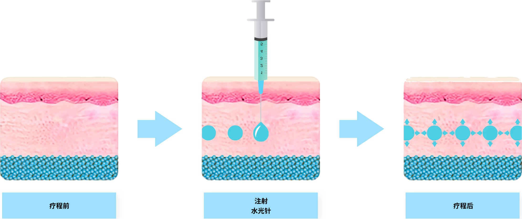 悬挂架 透明图片_悬挂架 透明大全/细节图 - 搜好货网海量高清精选图片